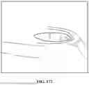 Fig. 197 - PIXEL ARRAY MEDICAL SYSTEMS, DEVICES AND METHODS