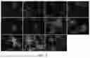 Fig. 06 - Methods for Making Stem Cell-Derived Enteric Neural Crest Cells and Their Use in Enteric Neuropathy Treatment