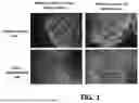 Fig. 02 - ADIPOSE COMPOSITIONS AND METHODS OF USE THEREOF