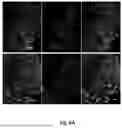 Fig. 09 - LIPOTEICHOIC ACID FROM STAPHYLOCOCCUS EPIDERMIDIS AND ITS USE TO MODULATE NEURONAL ACTIVITY VIA PD-1 INHIBITORY SIGNALLING IN NEURONS