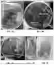 Fig. 05 - ENGINEERED S. TYPHIMURIUM AND USES THEREOF