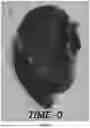 Fig. 02 - ORAL HYDROGEL WOUND DRESSING