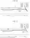 Fig. 07 - PARKING ASSIST DEVICE AND PARKING ASSIST METHOD