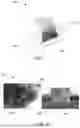Fig. 05 - Compute system with acne diagnostic mechanism and method of operation thereof