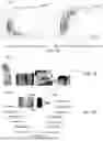 Fig. 11 - Compute system with acne diagnostic mechanism and method of operation thereof