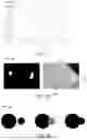 Fig. 18 - Compute system with acne diagnostic mechanism and method of operation thereof