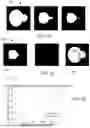Fig. 19 - Compute system with acne diagnostic mechanism and method of operation thereof