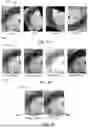 Fig. 24 - Compute system with acne diagnostic mechanism and method of operation thereof