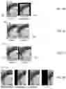 Fig. 25 - Compute system with acne diagnostic mechanism and method of operation thereof