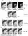 Fig. 26 - Compute system with acne diagnostic mechanism and method of operation thereof