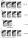 Fig. 27 - Compute system with acne diagnostic mechanism and method of operation thereof