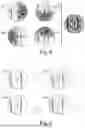 Fig. 06 - Method And System For Object Detection In LIDAR Generated 3D Point Clouds