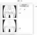 Fig. 09 - BONE DISEASE PREDICTION DEVICE, METHOD, PROGRAM, LEARNING DEVICE, METHOD, PROGRAM, AND TRAINED NEURAL NETWORK