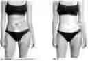 Fig. 03 - Systems and Methods for Training Muscle Activation and Awareness