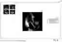 Fig. 08 - SYSTEMS AND METHODS FOR AUTOMATIC MEASUREMENTS OF MEDICAL IMAGES