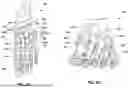 Fig. 06 - ORTHOPEDIC RASP AND SURGICAL TECHNIQUE FOR PREPARING AN INTERCUNEIFORM JOINT FOR FUSION
