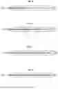 Fig. 03 - INTRAVASCULAR LITHOTRIPSY CATHETER WITH MOVABLE EMITTERS