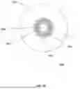 Fig. 05 - INTRAVASCULAR LITHOTRIPSY CATHETER WITH MOVABLE EMITTERS
