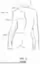 Fig. 04 - EXTERNAL ADJUSTMENT DEVICE FOR DISTRACTION DEVICE
