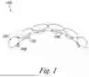 Fig. 02 - METHODS OF FORMING WIRE ATTACHMENT DENTAL APPLIANCES