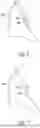 Fig. 06 - METHODS OF FORMING WIRE ATTACHMENT DENTAL APPLIANCES