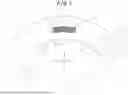 Fig. 02 - TIRE