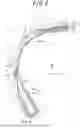 Fig. 06 - TIRE