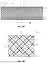 Fig. 04 - BRAIDED MEDICAL DEVICE AND METHOD
