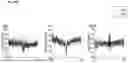 Fig. 97 - Methods and Compositions for Treating Diseases Associated with Exhausted T Cells