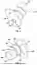 Fig. 03 - Medical device having a valve for autoclavability