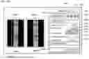 Fig. 18 - SHAPE INSPECTION DEVICE, PROCESSING DEVICE, HEIGHT IMAGE PROCESSING DEVICE