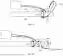 Fig. 30 - DEVICES AND METHODS FOR TISSUE REPAIR