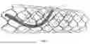 Fig. 08 - METHOD AND DEVICE FOR ANEURYSM REPAIR USING INTRAOPERATIVE ENDOLUMINAL COUPLING TO PRE-IMPLANTED STENT FOR DUAL BARRIER FORMATION