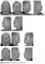 Fig. 02 - SKIN CARE NUTRACEUTICAL COMPOSITION