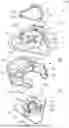 Fig. 01 - GLASS BREAKER