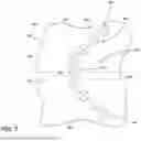 Fig. 08 - GAS TURBINE ENGINE COMBUSTOR WITH A SET OF DILUTION PASSAGES