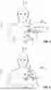Fig. 04 - MEDICAL DEVICE AND METHOD FOR DETERMINING THE NUMBER OF STEPS USING SUCH MEDICAL DEVICE