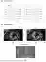 Fig. 02 - METHOD AND APPARATUS FOR IMPROVED COMPOSITE MULTI-WAVELENGTH PHOTOTHERMAL INFRARED IMAGING