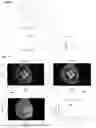 Fig. 07 - METHOD AND APPARATUS FOR IMPROVED COMPOSITE MULTI-WAVELENGTH PHOTOTHERMAL INFRARED IMAGING