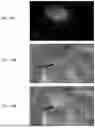Fig. 43 - SYSTEMS AND METHODS FOR SIMULTANEOUS NEAR-INFRARED LIGHT AND VISIBLE LIGHT IMAGING