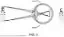 Fig. 02 - Custom Corrective Lens