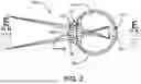 Fig. 03 - Custom Corrective Lens