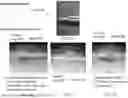 Fig. 43 - ACCOMMODATING CAVITY LENS SHAPED WITH PHOTOCLEAVABLE INSERT