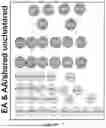 Fig. 101 - METHODS AND SYSTEMS FOR MACHINE LEARNING ANALYSIS OF SINGLE NUCLEOTIDE POLYMORPHISMS IN LUPUS
