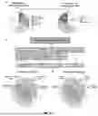 Fig. 131 - METHODS AND SYSTEMS FOR MACHINE LEARNING ANALYSIS OF SINGLE NUCLEOTIDE POLYMORPHISMS IN LUPUS