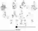 Fig. 139 - METHODS AND SYSTEMS FOR MACHINE LEARNING ANALYSIS OF SINGLE NUCLEOTIDE POLYMORPHISMS IN LUPUS