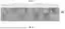 Fig. 20 - METHODS AND SYSTEMS FOR MACHINE LEARNING ANALYSIS OF SINGLE NUCLEOTIDE POLYMORPHISMS IN LUPUS