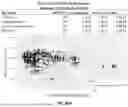 Fig. 207 - METHODS AND SYSTEMS FOR MACHINE LEARNING ANALYSIS OF SINGLE NUCLEOTIDE POLYMORPHISMS IN LUPUS