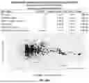 Fig. 211 - METHODS AND SYSTEMS FOR MACHINE LEARNING ANALYSIS OF SINGLE NUCLEOTIDE POLYMORPHISMS IN LUPUS