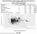 Fig. 212 - METHODS AND SYSTEMS FOR MACHINE LEARNING ANALYSIS OF SINGLE NUCLEOTIDE POLYMORPHISMS IN LUPUS
